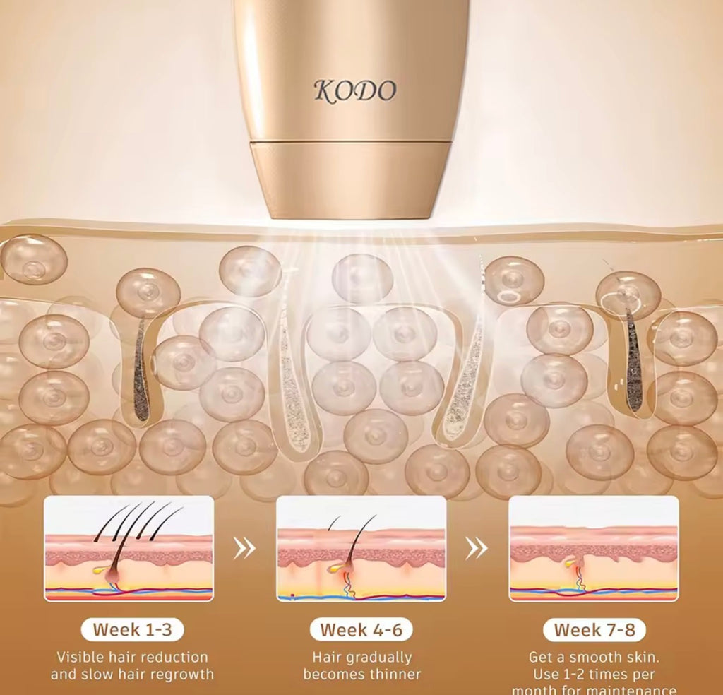 KODO 2026 High-end Customization Ice Laser Hair Removal Laser Epilator Permanent IPL Painless Photoepilator 4 in 1 Face and Body