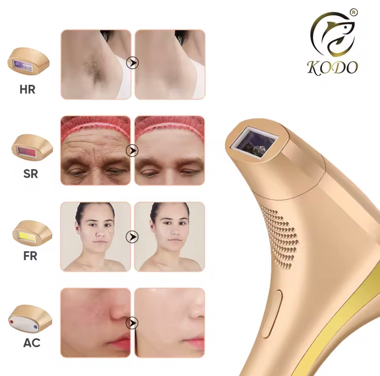 KODO 2026 High-end Customization Ice Laser Hair Removal Laser Epilator Permanent IPL Painless Photoepilator 4 in 1 Face and Body